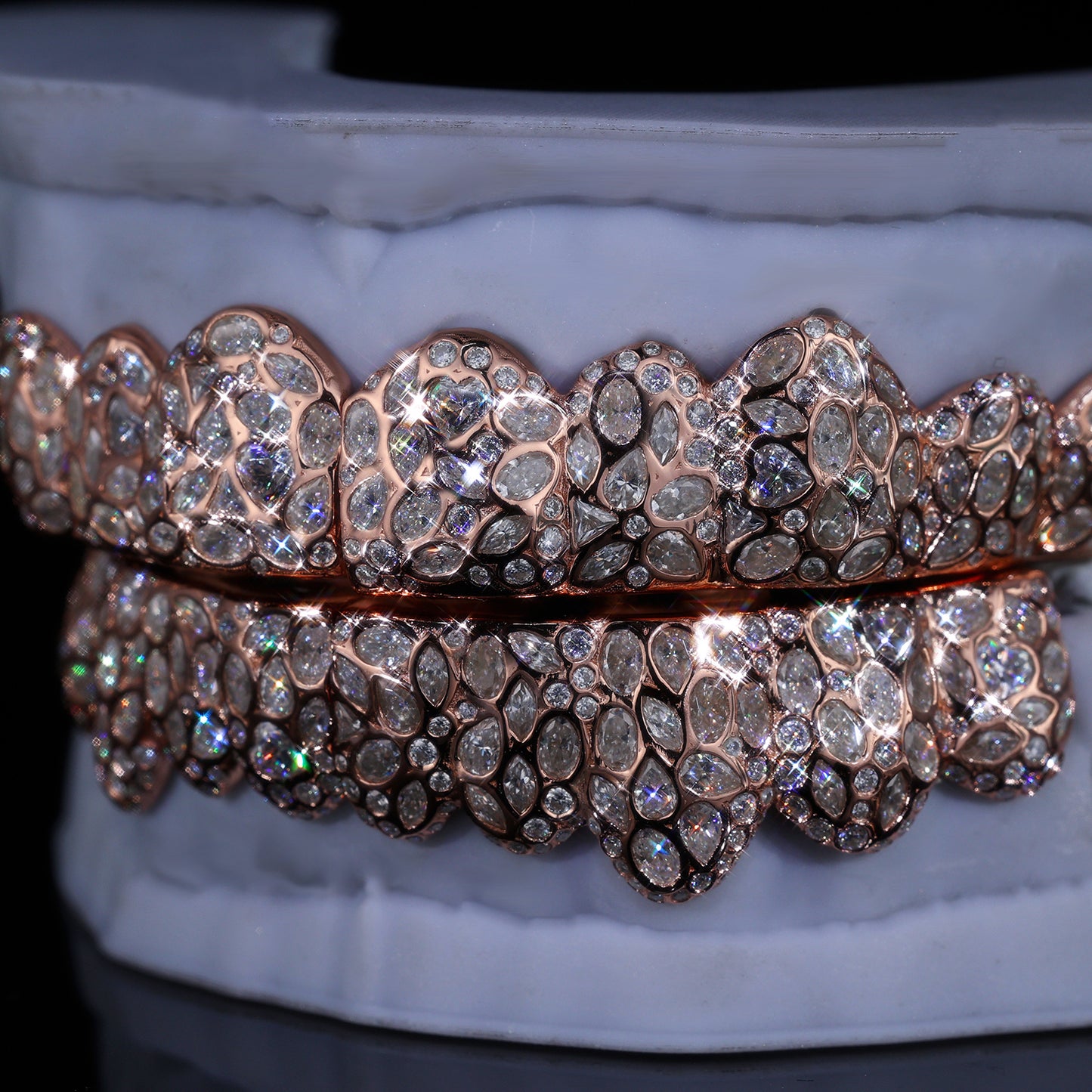 Ultimate Fully Flooded Double Row Grillz | Custom Bling Teeth