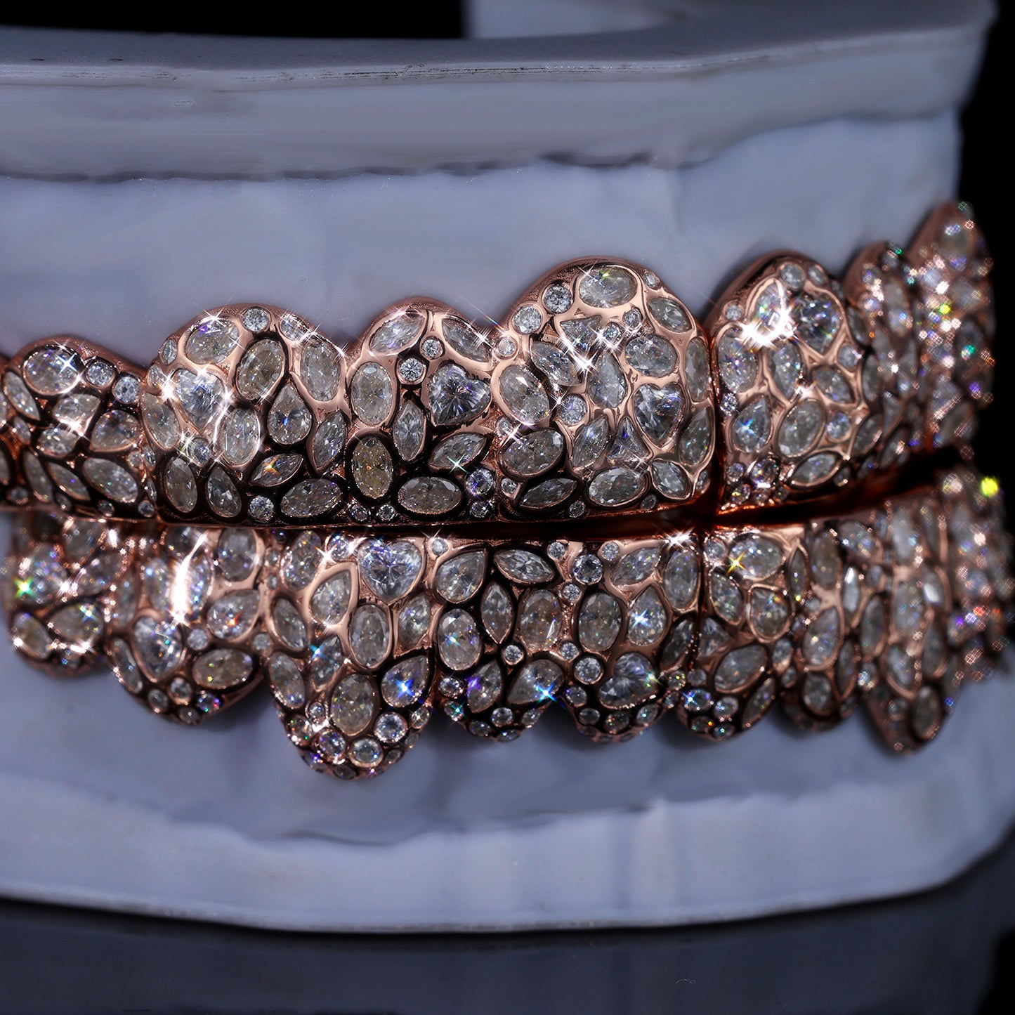 Ultimate Fully Flooded Double Row Grillz | Custom Bling Teeth