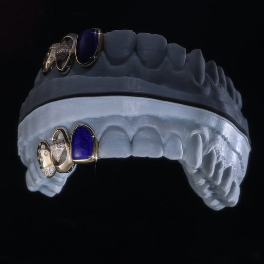 Luxury Blue Gemstone & Diamond Grillz | Custom Hip Hop Teeth