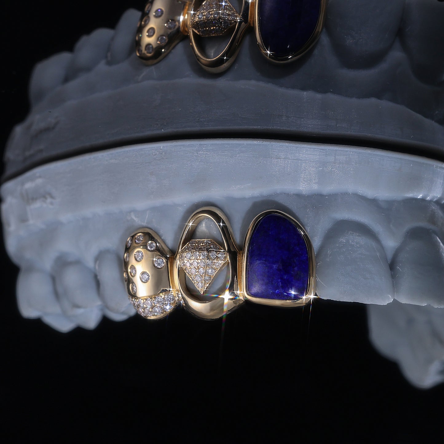 Luxury Blue Gemstone & Diamond Grillz | Custom Hip Hop Teeth