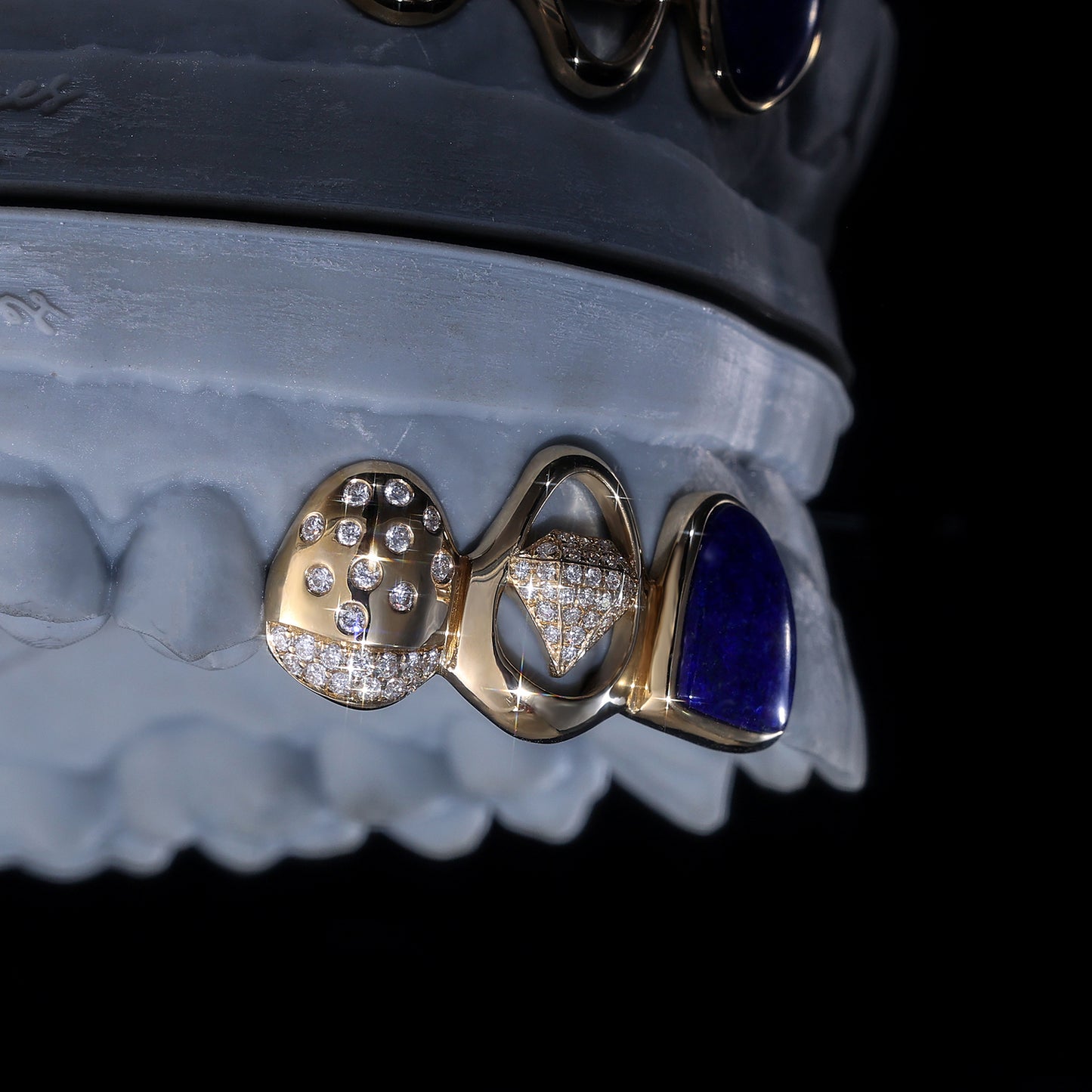 Luxury Blue Gemstone & Diamond Grillz | Custom Hip Hop Teeth
