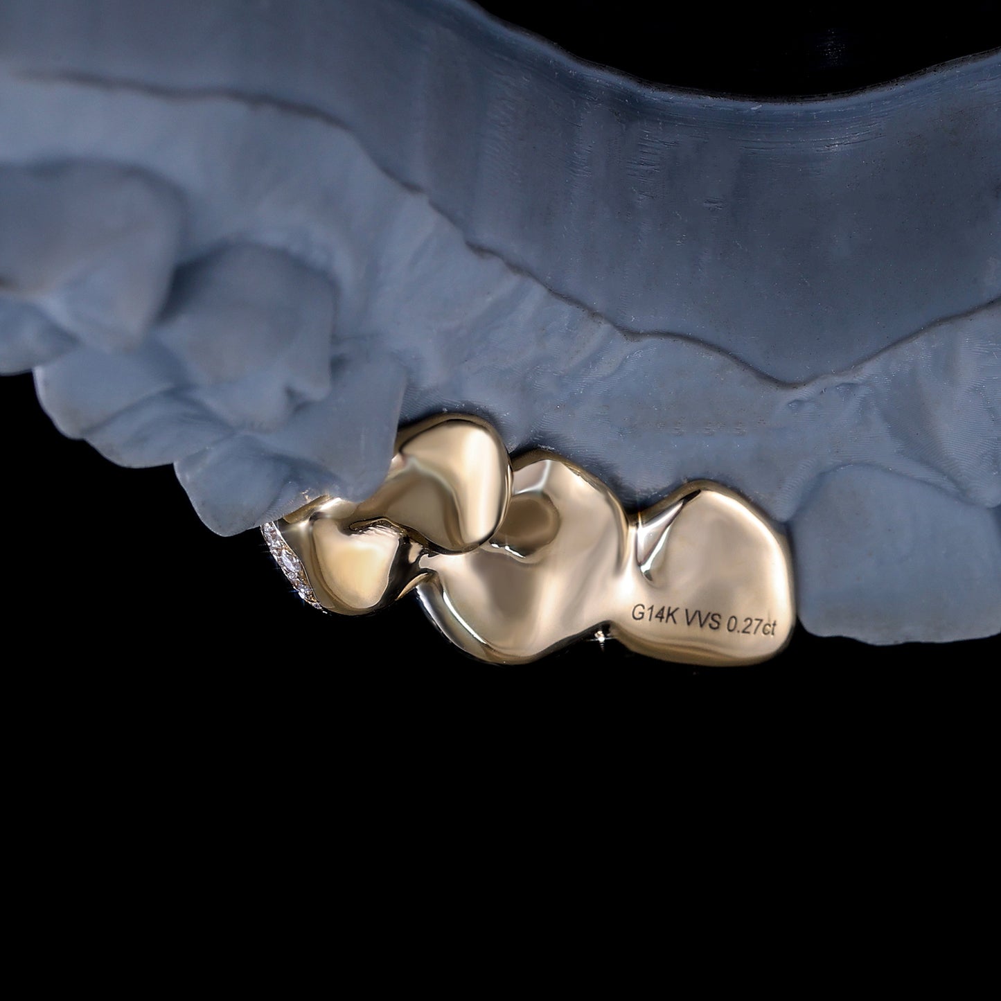 Luxury Blue Gemstone & Diamond Grillz | Custom Hip Hop Teeth