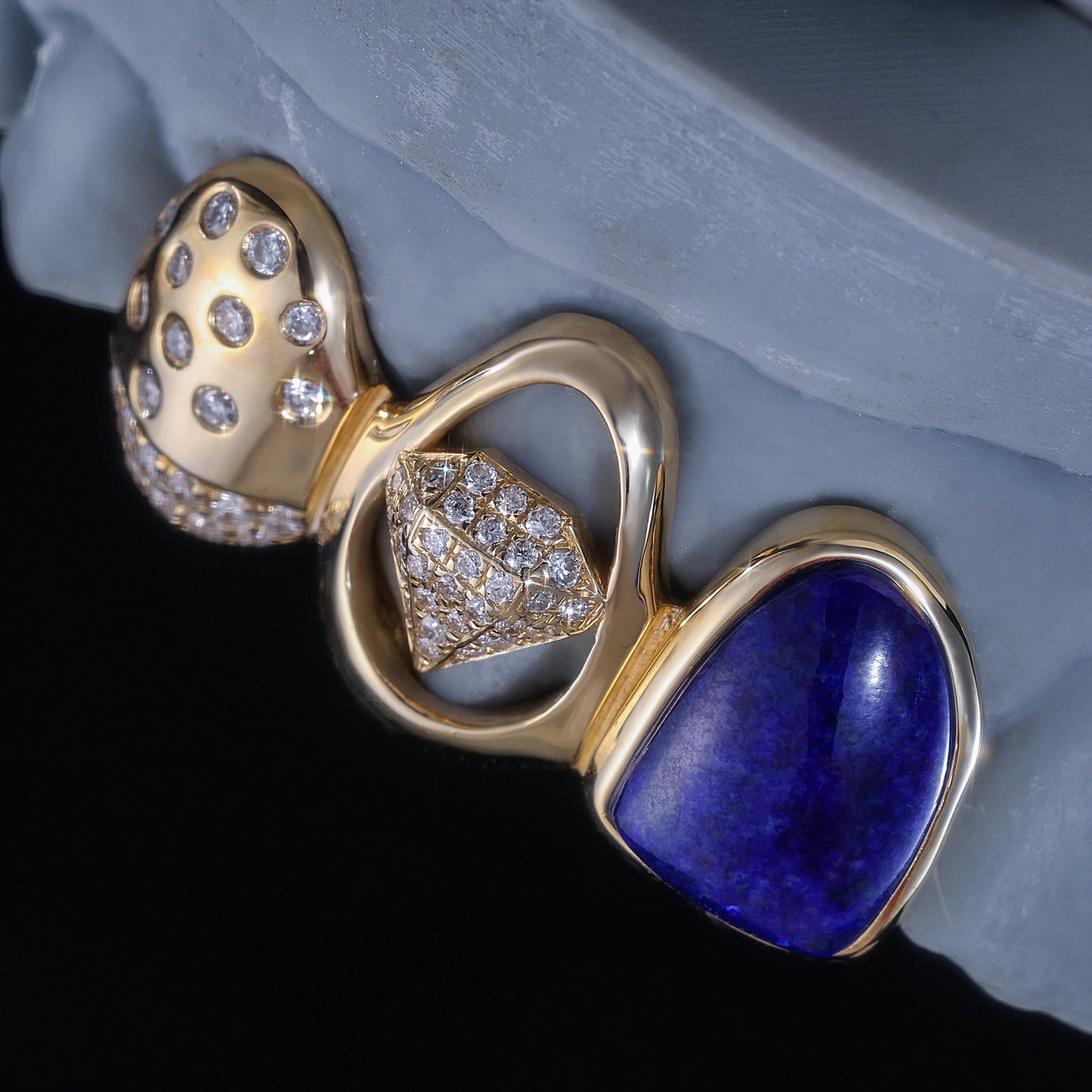 Luxury Blue Gemstone & Diamond Grillz | Custom Hip Hop Teeth